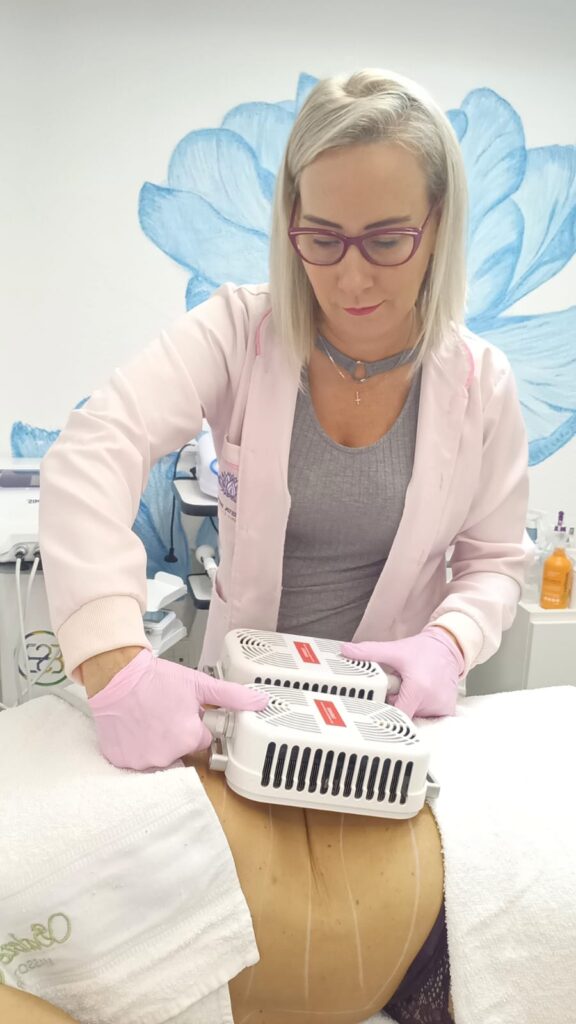 Foto Criolipólise de Placas