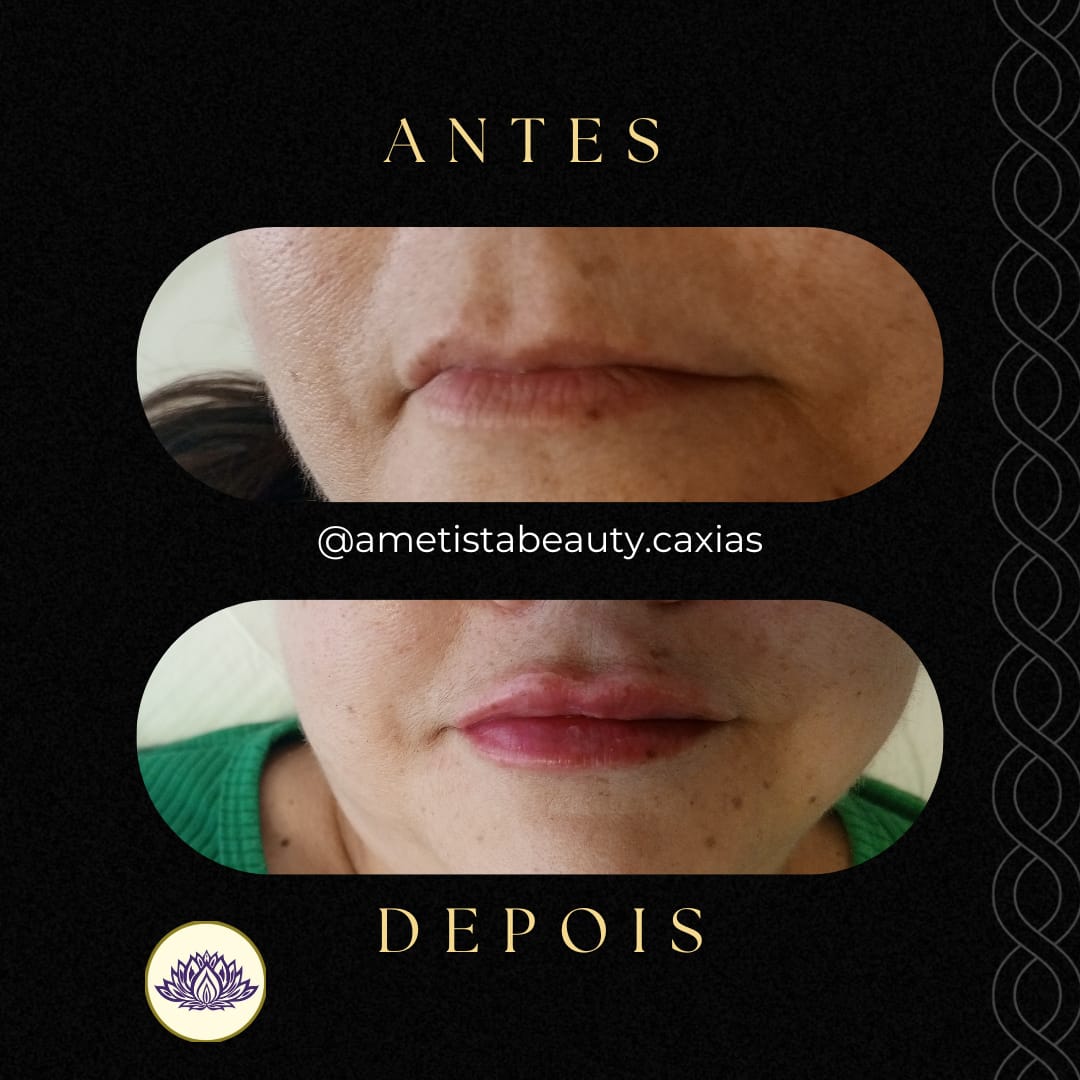 Imagem do WhatsApp de 2024-12-12 à(s) 15.55.55_0ad7dcc3