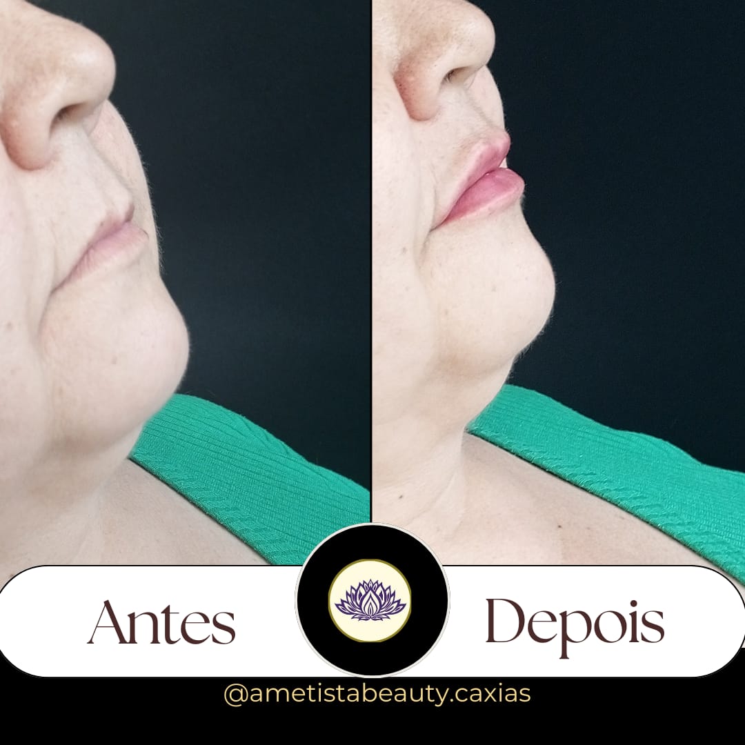 Imagem do WhatsApp de 2024-12-12 à(s) 15.55.55_84768141