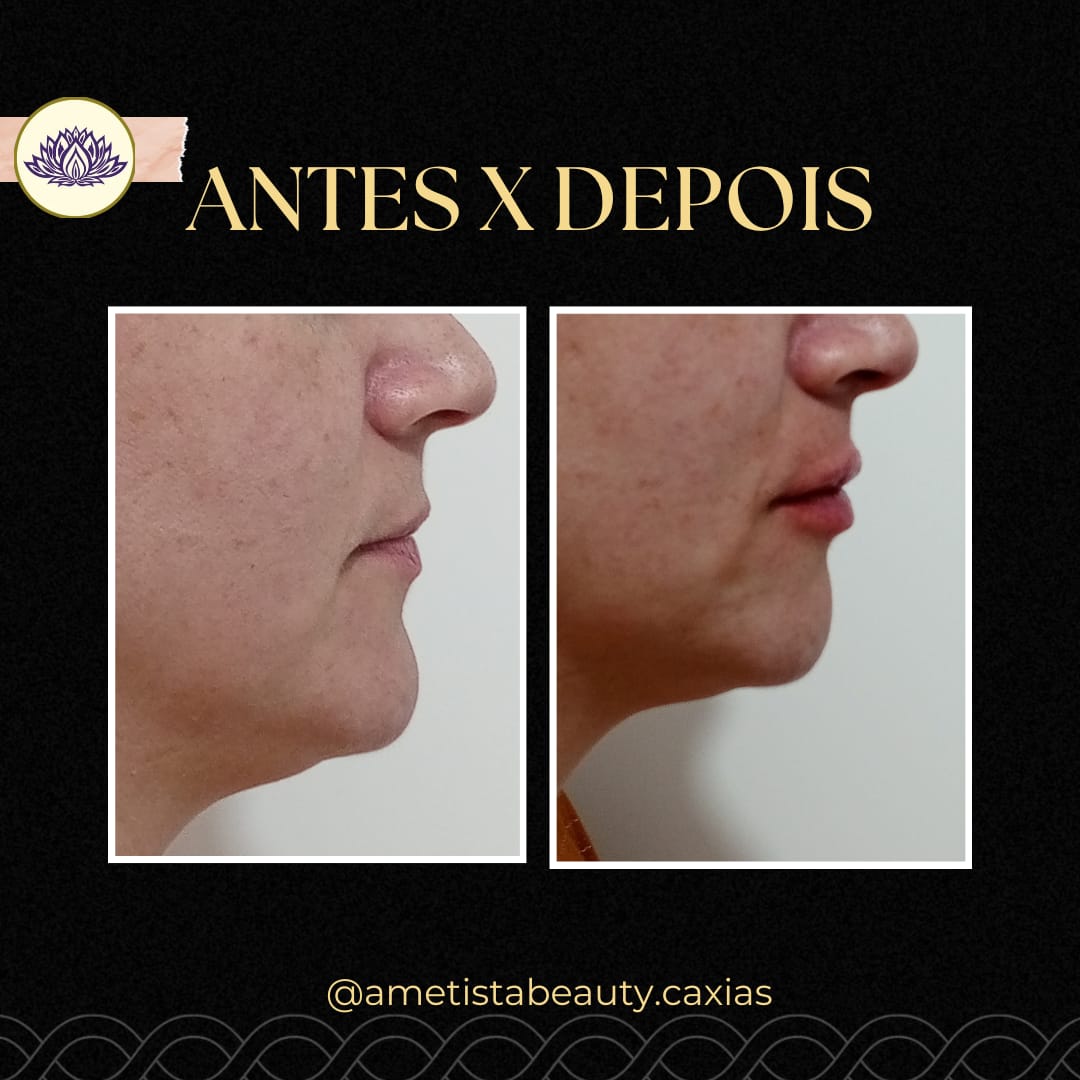 Imagem do WhatsApp de 2024-12-12 à(s) 15.56.25_41118a5a