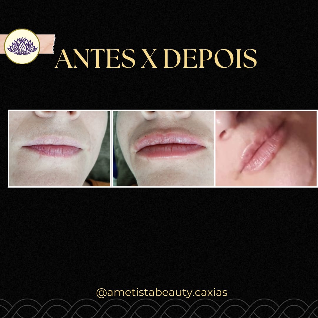 Imagem do WhatsApp de 2024-12-12 à(s) 15.56.25_b8fb47ff